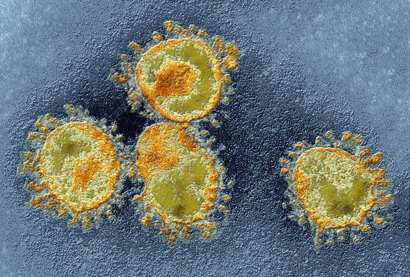 C0023231-Human_coronavirus,_TEM.jpg